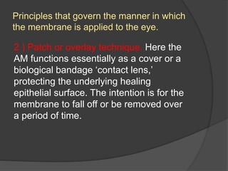 Principles that govern the manner in which
the membrane is applied to the eye.
2 ) Patch or overlay technique. Here the
AM functions essentially as a cover or a
biological bandage ‘contact lens,’
protecting the underlying healing
epithelial surface. The intention is for the
membrane to fall off or be removed over
a period of time.
 