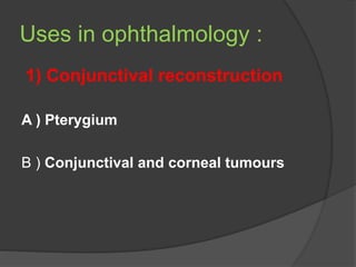 Uses in ophthalmology :
1) Conjunctival reconstruction
A ) Pterygium
B ) Conjunctival and corneal tumours
 