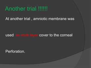 Another trial !!!!!!
At another trial , amniotic membrane was
used as multi layer cover to the corneal
Perforation.
 
