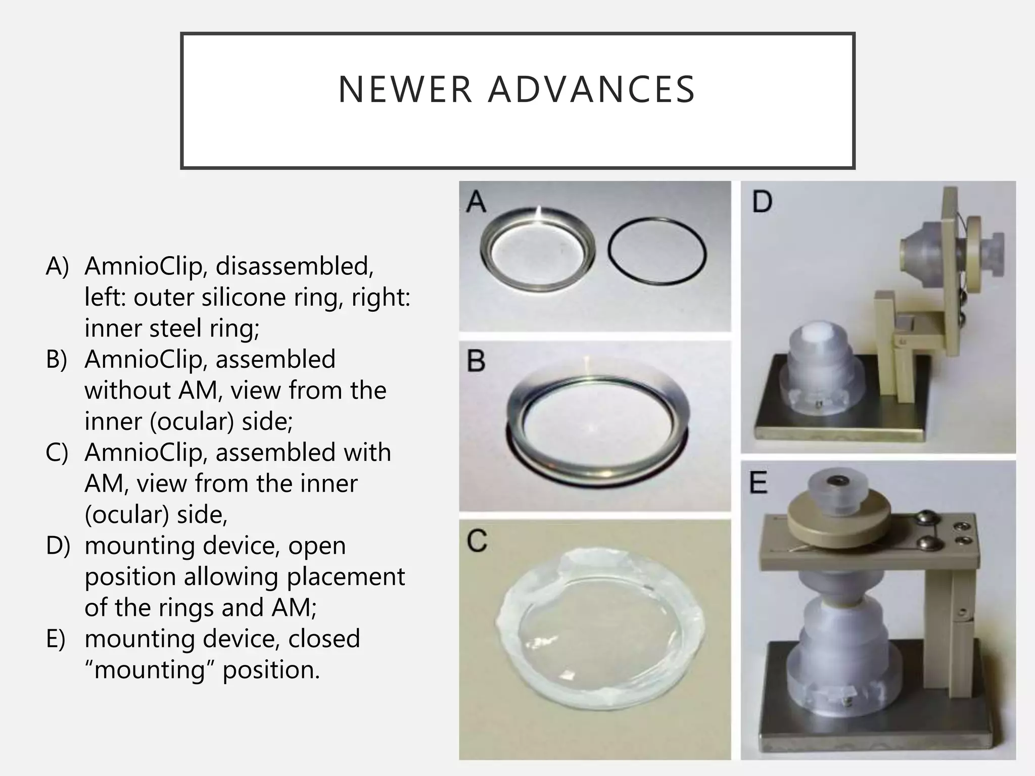 Allowrap Amniotic membrane in ophthalmology | PPTX
