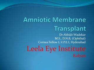 Dr Abhijit Wadekar
M.S., D.N.B, (Ophthal)
Cornea Fellow L.V.P.E.I, Hyderabad
Leela Eye Institute
Kalyan
 