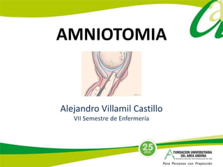 AMNIOTOMIA
Alejandro Villamil Castillo
VII Semestre de Enfermería
 