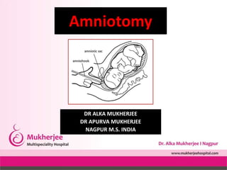 DR ALKA MUKHERJEE
DR APURVA MUKHERJEE
NAGPUR M.S. INDIA
Amniotomy
 