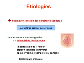 Etiologies
 orientation fonction des caractères sexuels II
1-Malformations utéro-vaginales:
a – aménorrhée douloureuse
- imperforation de l’hymen
- cloison vaginale transverse
- aplasie vaginale complète ou partielle
traitement : chirurgie
caractères sexuels II normaux
 
