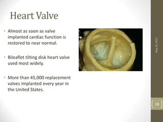 Heart Valve
• Almost as soon as valve
implanted cardiac function is
restored to near normal.
• Bileaflet tilting disk heart valve
used most widely.
• More than 45,000 replacement
valves implanted every year in
the United States.
May20,2013
18
 