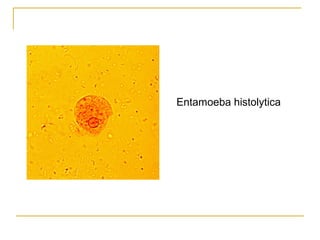 Entamoeba histolytica
 