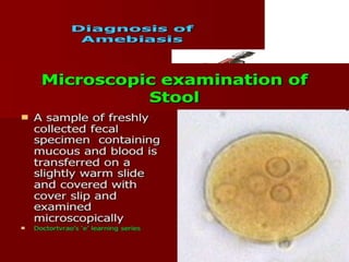 Amoebiasis