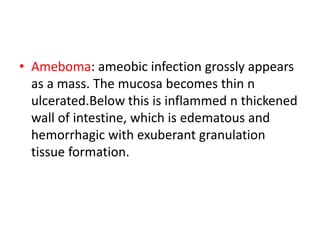 • Ameboma: ameobic infection grossly appears
as a mass. The mucosa becomes thin n
ulcerated.Below this is inflammed n thickened
wall of intestine, which is edematous and
hemorrhagic with exuberant granulation
tissue formation.