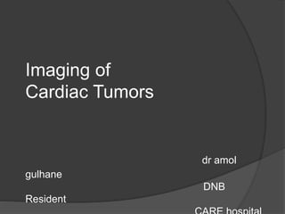 Imaging of
Cardiac Tumors
dr amol
gulhane
DNB
Resident
 
