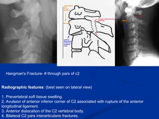 Radiographic features: (best seen on lateral view)
1. Prevertebral soft tissue swelling.
2. Avulsion of anterior inferior corner of C2 associated with rupture of the anterior
longitudinal ligament.
3. Anterior dislocation of the C2 vertebral body.
4. Bilateral C2 pars interarticularis fractures.
Hangman's Fracture- # through pars of c2
 