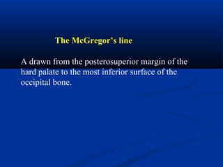 A drawn from the posterosuperior margin of the
hard palate to the most inferior surface of the
occipital bone.
The McGregor’s line
 
