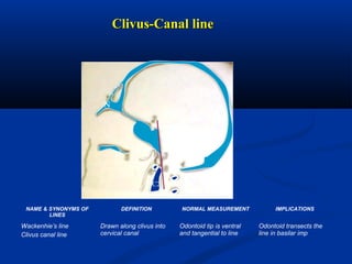Clivus-Canal lineClivus-Canal line
C
B
OC2
H
N
NAME & SYNONYMS OF
LINES
DEFINITION NORMAL MEASUREMENT IMPLICATIONS
Wackenhie’s line
Clivus canal line
Drawn along clivus into
cervical canal
Odontoid tip is ventral
and tangential to line
Odontoid transects the
line in basilar imp
 