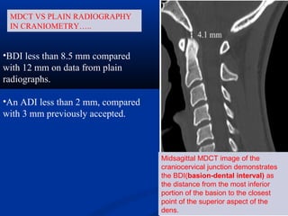 •BDI less than 8.5 mm compared
with 12 mm on data from plain
radiographs.
•An ADI less than 2 mm, compared
with 3 mm previously accepted.
Midsagittal MDCT image of the
craniocervical junction demonstrates
the BDI(basion-dental interval) as
the distance from the most inferior
portion of the basion to the closest
point of the superior aspect of the
dens.
MDCT VS PLAIN RADIOGRAPHY
IN CRANIOMETRY…..
 