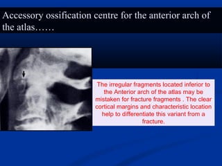 The irregular fragments located inferior to
the Anterior arch of the atlas may be
mistaken for fracture fragments . The clear
cortical margins and characteristic location
help to differentiate this variant from a
fracture.
Accessory ossification centre for the anterior arch of
the atlas……
 