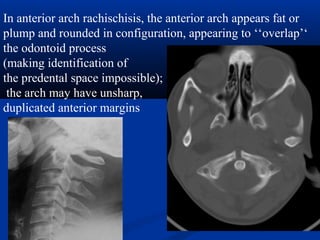 In anterior arch rachischisis, the anterior arch appears fat or
plump and rounded in configuration, appearing to ‘‘overlap’‘
the odontoid process
(making identification of
the predental space impossible);
the arch may have unsharp,
duplicated anterior margins
 