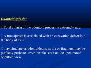 OdontoidAplasia:
�Total aplasia of the odontoid process is extremely rare.
�A true aplasia is associated with an excavation defect into
the body of axis.
�may simulate os odontoideum, as the os fragment may be
perfectly projected over the atlas arch on the open mouth
odontoid view.
 