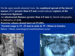 On the open mouth odontoid view, the combined spread of the lateral
masses of C1 greater than 6.9 mm would indicate rupture of the
transverse ligament.
An atlantoaxial distance greater than 4-5 mm by lateral radiographs,
is indicative of AAI.
Posterior atlanto dental interval (PADI):
Normal range is 19 –32 mm in male & 19 –30mm in females.
Below 19mm, neurological manifestations occur.
 