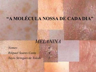 MELANINA Nomes:  nº Ritipael Soares Costa  4 Tayro Stringari de Toledo  5 “ A MOLÉCULA NOSSA DE CADA DIA” 