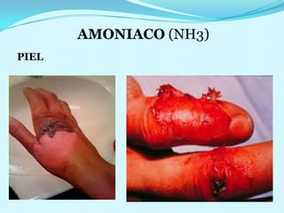 AMONIACO (NH3) PIEL 