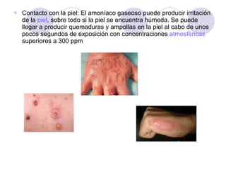 Contacto con la piel: El amoníaco gaseoso puede producir irritación de la  piel , sobre todo si la piel se encuentra húmeda. Se puede llegar a producir quemaduras y ampollas en la piel al cabo de unos pocos segundos de exposición con concentraciones  atmosféricas  superiores a 300 ppm 