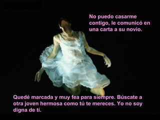 No puedo casarme contigo, le comunicó en una carta a su novio. Quedé marcada y muy fea para siempre. Búscate a otra joven hermosa como tú te mereces. Yo no soy digna de tí. 