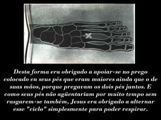 Desta forma era obrigado a apoiar-se no prego
colocado en seus pés que eram maiores ainda que o de
  suas mãos, porque pregavam os dois pés juntos. E
como seus pés não agüentariam por muito tempo sem
 rasgarem-se também, Jesus era obrigado a alternar
   esse "ciclo" simplesmente para poder respirar.
 