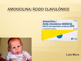 AMOXICILINA/ÁCIDO CLAVULÓNICO
Luis Muro
 