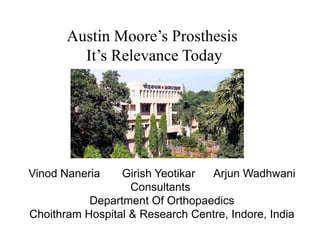 Austin Moore’s Prosthesis
         It’s Relevance Today




Vinod Naneria
Vi d N     i     Gi i h Y tik
                 Girish Yeotikar A j W dh
                                 Arjun Wadhwani    i
                   Consultants
           Department Of Orthopaedics
Choithram Hospital & Research Centre, Indore, India