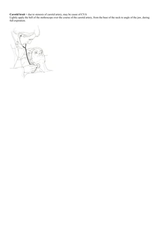 Carotid bruit = due to stenosis of carotid artery, may be cause of CVA
Lightly apply the bell of the stethoscope over the course of the carotid artery, from the base of the neck to angle of the jaw, during
full expiration.
 