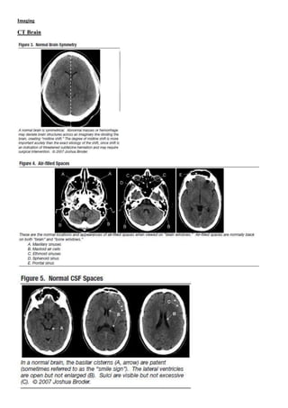 Imaging
CT Brain
 