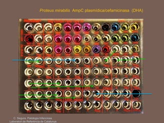 Proteus mirabilis AmpC plasmídica/cefamicinasa (DHA)
C. Segura. Patologia Infecciosa.
Laboratori de Referència de Catalunya
 