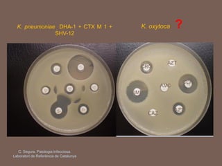 K. pneumoniae DHA-1 + CTX M 1 +
SHV-12
K. oxytoca ?
C. Segura. Patologia Infecciosa.
Laboratori de Referència de Catalunya
IMI
CEP
AZT
CRO
AMC
CAZ
AZT
 