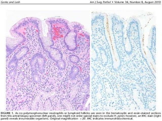 Classification de Whitehead (1972)