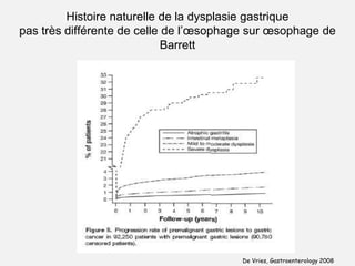  Infiltrat mononucléé : quelques mois