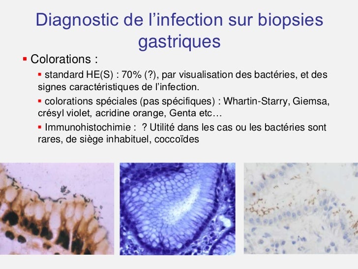Biopsies Antrales Et Fundiques A La Recherche D Hp