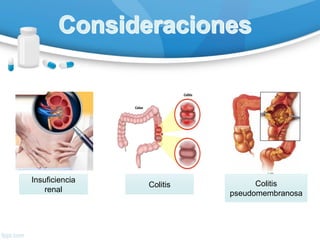 Insuficiencia
renal
Colitis Colitis
pseudomembranosa
 