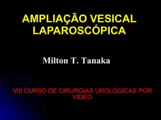 AMPLIAÇÃO VESICAL LAPAROSCÓPICA VIII CURSO DE CIRURGIAS UROLÓGICAS POR VÍDEO Milton T. Tanaka 