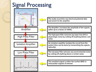 Signal Processing
 
