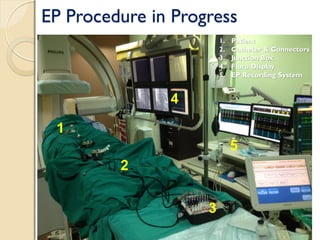 EP Procedure in Progress
1
2
3
4
5
1. Patient
2. Catheter & Connectors
3. Junction Box
4. Fluro Display
5. EP Recording System
 
