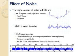 Effect of Noise
 The main sources of noise in ECG are
◦ Low Frequency noise (Baseline Wander)
 Muscle Tremor
 Respiration
◦ 50/60 Hz supply line noise
◦ High Frequency noise
 Other interference (i.e., radio frequency noise from other equipment)
 Fluorescent lamps / bulbs
 Any A/C Motor based equipment (pumps, Air Conditioners etc)
 