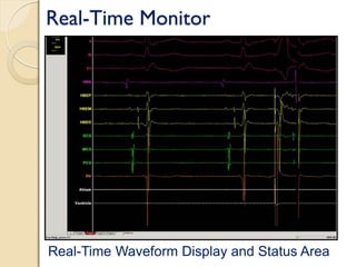 Real-Time Monitor
Real-Time Waveform Display and Status Area
 