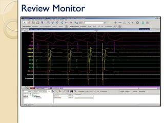 Review Monitor
 