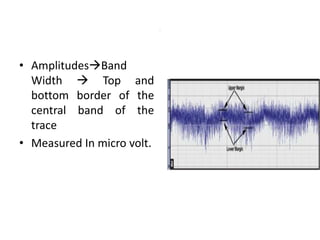.
• AmplitudesBand
Width  Top and
bottom border of the
central band of the
trace
• Measured In micro volt.
 