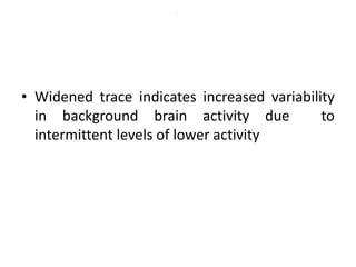 .
• Widened trace indicates increased variability
in background brain activity due to
intermittent levels of lower activity
 