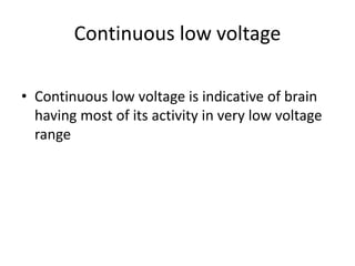 Continuous low voltage
• Continuous low voltage is indicative of brain
having most of its activity in very low voltage
range
 
