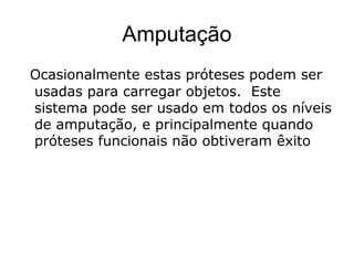 Amputação
Ocasionalmente estas próteses podem ser
usadas para carregar objetos. Este
sistema pode ser usado em todos os níveis
de amputação, e principalmente quando
próteses funcionais não obtiveram êxito
 