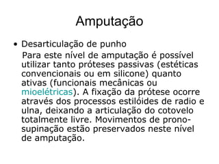 Amputação
• Desarticulação de punho
Para este nível de amputação é possível
utilizar tanto próteses passivas (estéticas
convencionais ou em silicone) quanto
ativas (funcionais mecânicas ou
mioelétricas). A fixação da prótese ocorre
através dos processos estilóides de radio e
ulna, deixando a articulação do cotovelo
totalmente livre. Movimentos de prono-
supinação estão preservados neste nível
de amputação.
 