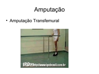Amputação
• Amputação Transfemural
 