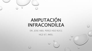 AMPUTACIÓN
INFRACONDÍLEA
DR. JOSE ABEL PEREZ HDZ R2CG
HGZ 67, IMSS.
 