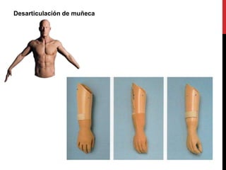 Desarticulación de muñeca
 